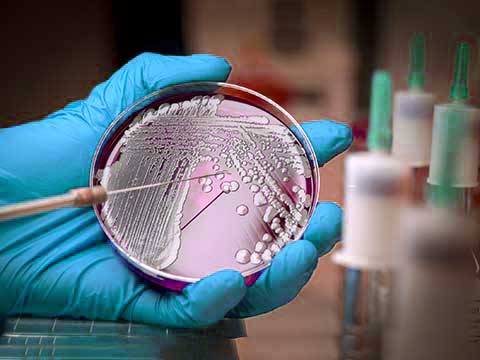 过氧化钙纳米颗粒助力破解“超级细菌”难题